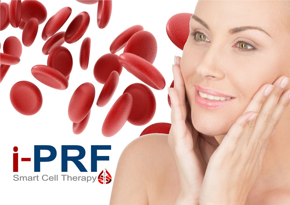 PRF