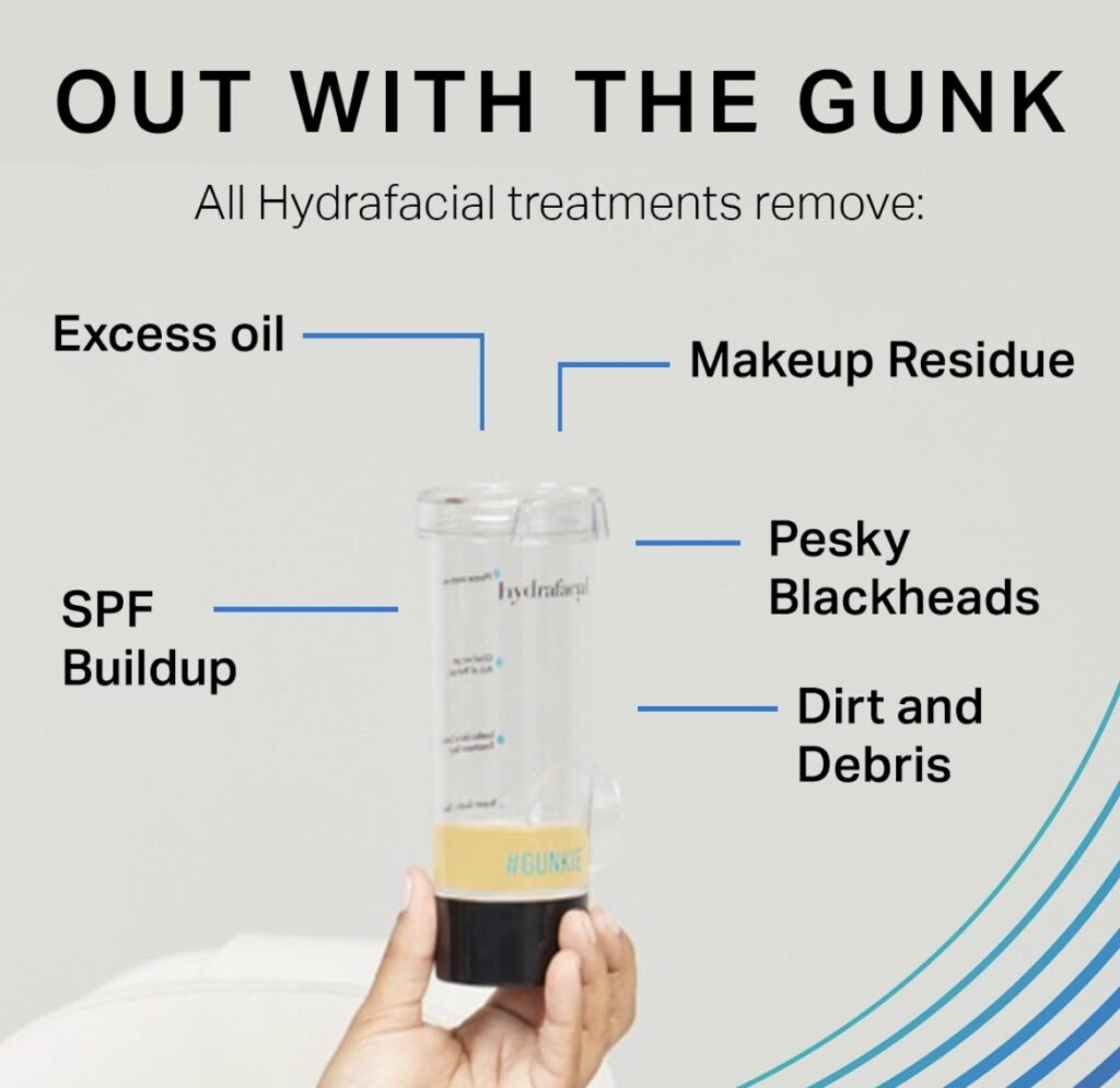 After-HydraFacial impurities extraction