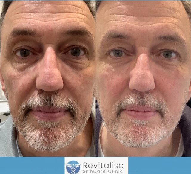 Aesthetic treatments for men in Bath and Wiltshire